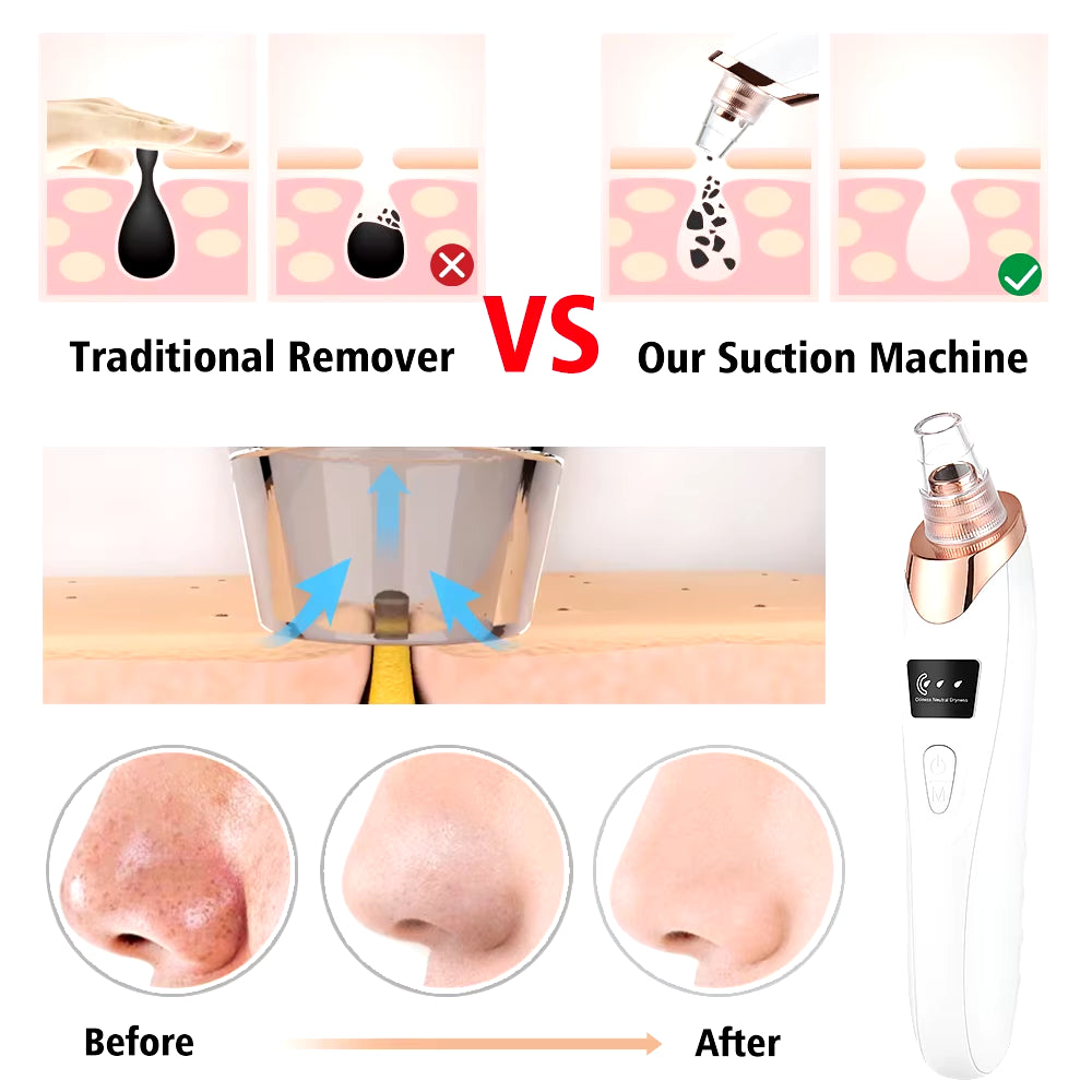 Electric Vacuum Suction Blackhead Remover Facial Pore Cleaner Comedone Spot Acne Pimple Blackhead Extractor USB Rechargeable