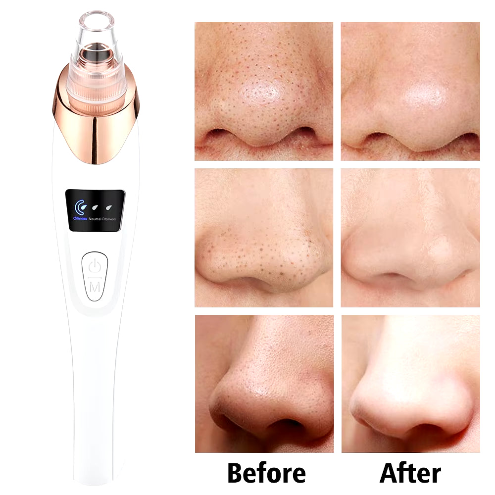 Electric Vacuum Suction Blackhead Remover Facial Pore Cleaner Comedone Spot Acne Pimple Blackhead Extractor USB Rechargeable